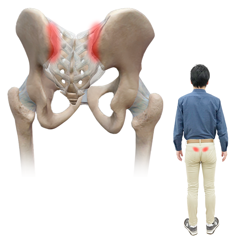 腰痛ベルト コルセット が効く人 効かない人の特徴とは 腰痛メディア Zen Placeが発信する痛みの情報サイト 腰痛ベルト コルセット が効く人 効かない人の特徴とは 腰痛メディア Zen Placeが発信する痛みの情報サイト